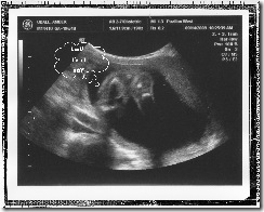 Ultrasound Boy 1 copy