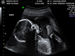 Little Man in the Beginning 2011