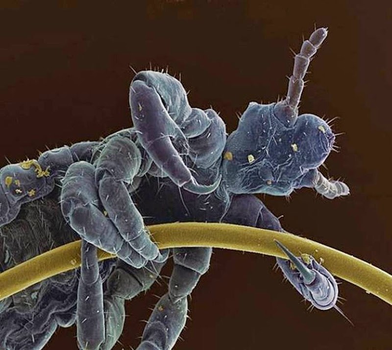 16 Terryfying Images From The Microscope - A head lice clinging to a human hair