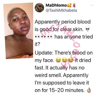 Lady applied her 'Flower blood' on face to clear pimples.