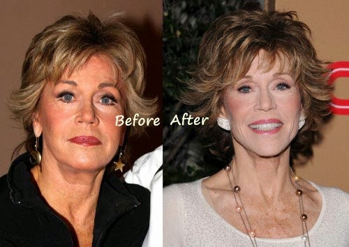 Jane Fonda Plastic Surgery Before and After Breast ...