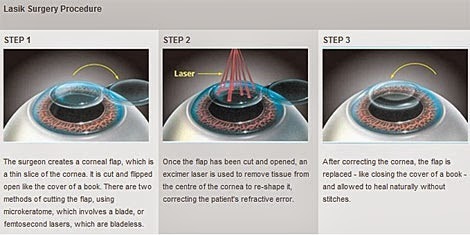 India cost eye care surgery | eye care surgery in India