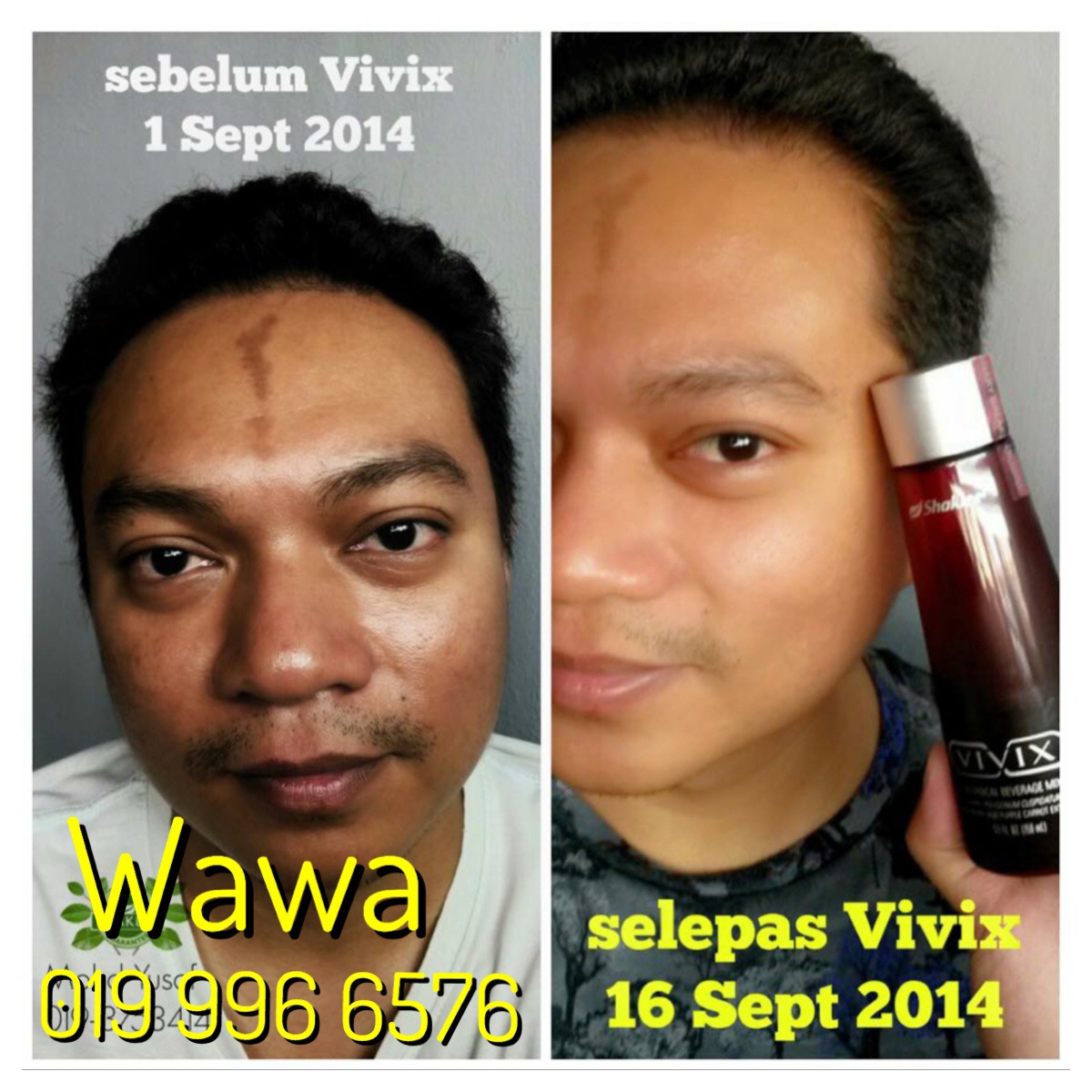 Testimoni Vivix - Manfaat Awet Muda Dan Detox Sel 