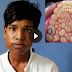 WATCH: 232 Teeth From Indian boy's mouth 