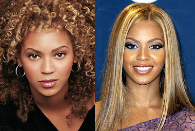 Beyonce Before and After Plastic Surgery