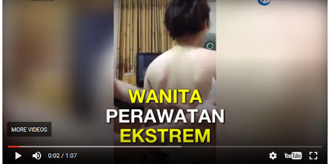 Demi Cantik, Wanita Ini Rela Menjalankan Perawatan Super Menyakitkan