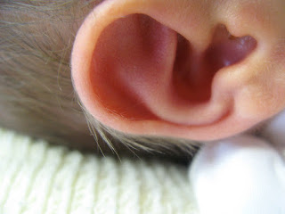 5 How to Cure an Ear Infection at Home