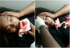 Mercy Aigbe battered by her estranged husband, see her brusied face (Watch Video)