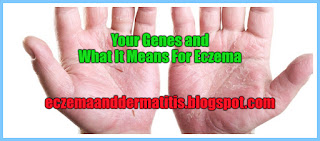 Your Genes and What It Means For Eczema