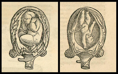 baby positions in the uterus - 1554