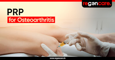 prp-for-osteoarthritis