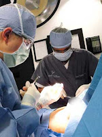 breast-surgery-image