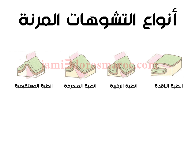 التشوهات التكتونية المرنة