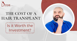 Hair Transplant Cost Vs Benefits