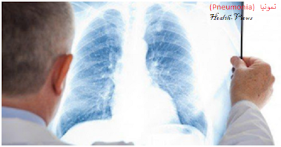 General information about (Pneumonia)   نمونیا