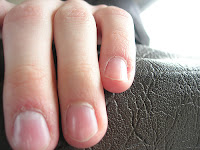 Fingernails