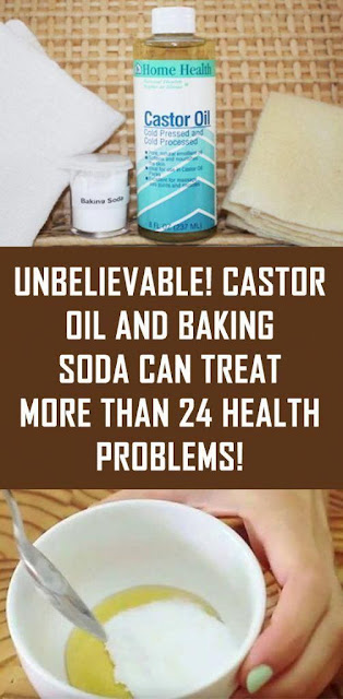 Castor Oil and Baking Soda Can Treat More Than 24 Health Problems