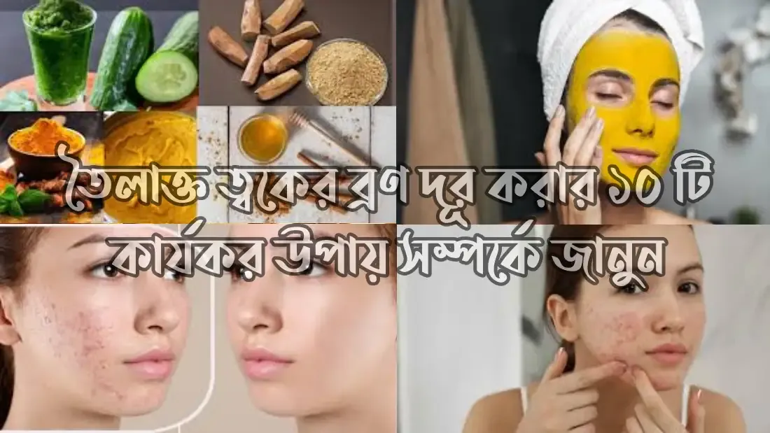 তৈলাক্ত-ত্বকের-ব্রণ-দূর-করার-উপায়