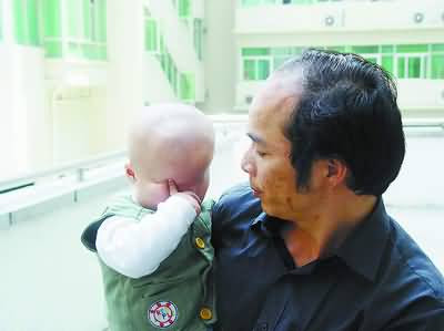 Chinese boy born with no eyes