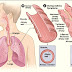 What Does Asthma Feel like and What You Should be Doing