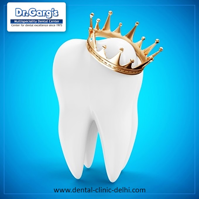 Evaluating Tooth Crown Cost in India