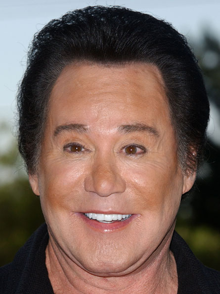 Total Celebrity: Wayne Newton Plastic Surgery