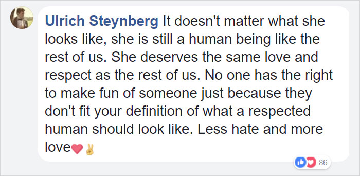 Awful Twitter User Shares The Picture Of A 9-Year-Old Girl With Facial Deformation To Promote Abortion. The Mother's Response Was Powerful!