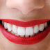 Thuốc làm trắng răng eucryl và thành phần cấu tạo