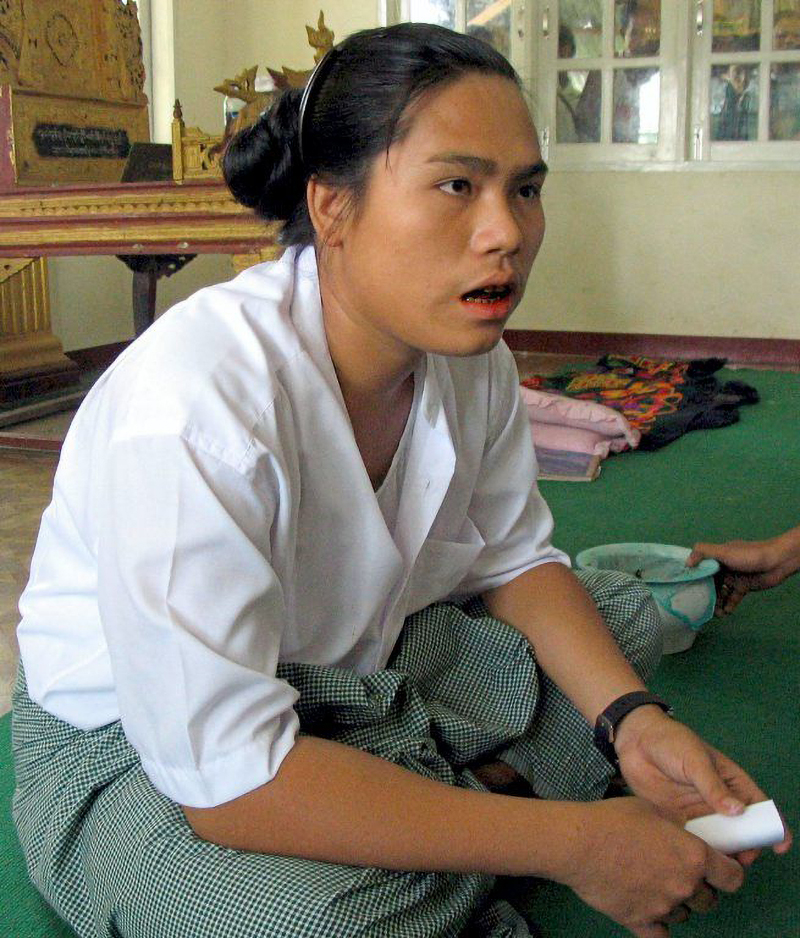 Chuyện lạ có thật: Một phụ nữ Myanmar biến thành đàn ông sau khi ngủ dậy