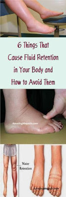 6 Things That Cause Fluid Retention in Your Body and How to Avoid Them