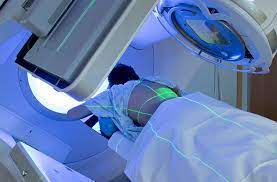 Radiotherapy is