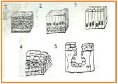 Image result for epitel alveolus majemuk