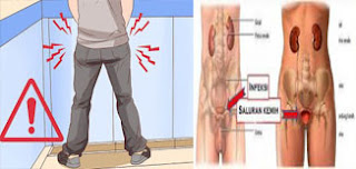Cara Mengatasi Kemaluan Nyeri Saat Buang Air Kecil Pada Laki laki