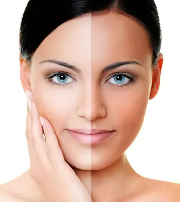 Comment enlever le bronzage du visage et de la peau - 12 remèdes, options de traitement + conseils
