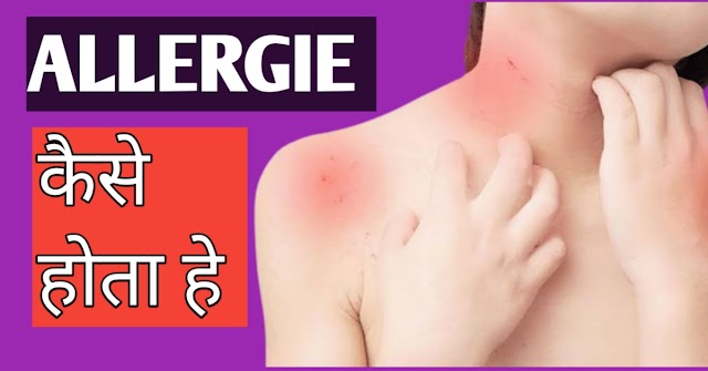 skin allergy kya hai, skin allergy ke gharelu upay,स्किन एलर्जी के सामान्य लक्षण