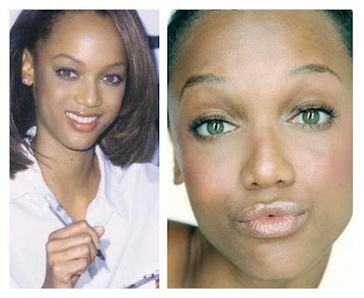 pictures of lady gaga before plastic surgery. Tyra Banks Before And After