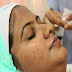 Forms Of Zits Therapy And Also Zits Keloid Therapy