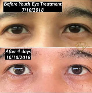 Testimoni YOUTH Restoring Eye Treatment