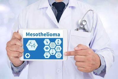 Mesothelioma Life Expectancy