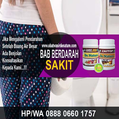 Obat Herbal Ambeien Luar