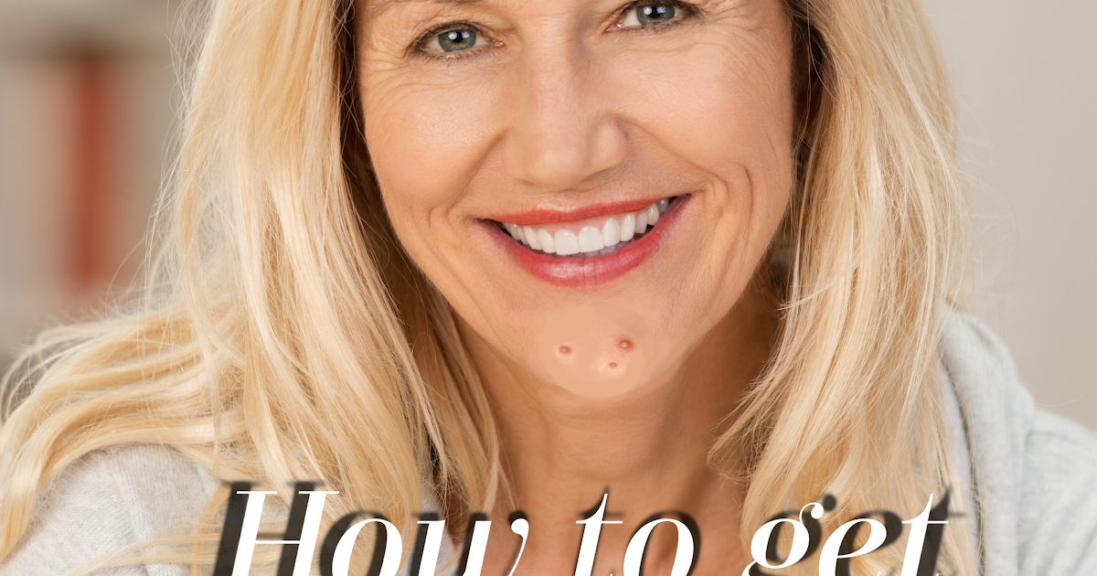 How to get rid of adult acne!