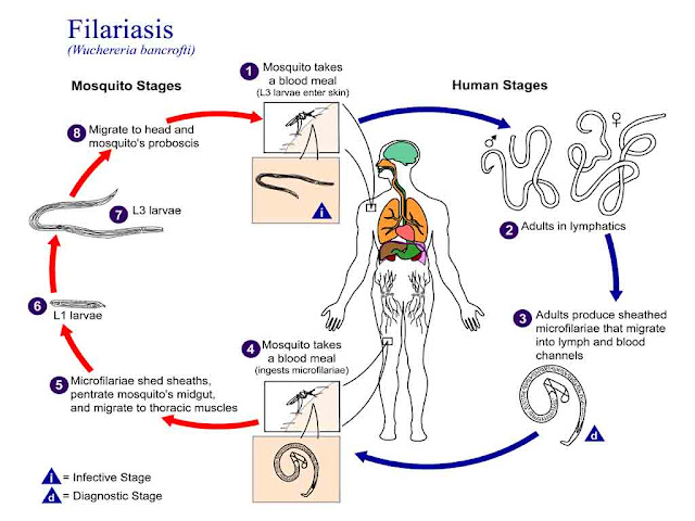लिम्फेटिक फाइलेरियासिस से संबन्धित महत्वपूर्ण जानकारी |Lymphatic Filariasis Disease Details in Hindi