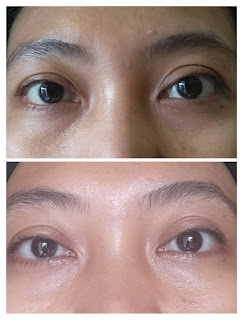 Review npure marigold eye serum