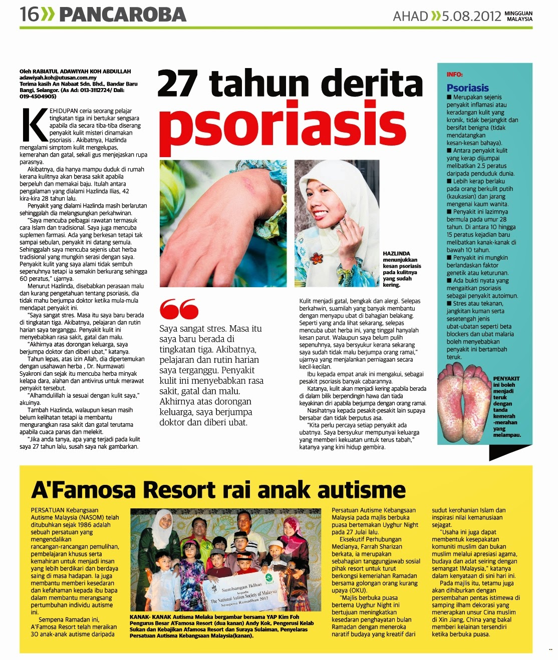 27 Tahun Derita Psoriasis ~ RUMAH SIHAT AN-NABAAT