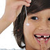Nhổ răng sữa cho trẻ đúng cách tại nha khoa 