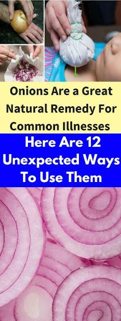 Onions Are a Great Natural Remedy For Common Illnesses – Here Are 12 Unexpected Ways To Use Them