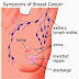 Breakdown of breast cancers - Signs and Symptoms of breast cancer