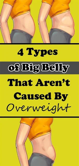 4 Types of Big Belly That Aren’t Caused By Overweight