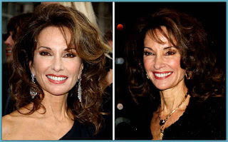 Susan Lucci Plastic Surgery