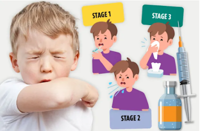 The 100-Day Cough: What Brits Need to Know About Whooping Cough
